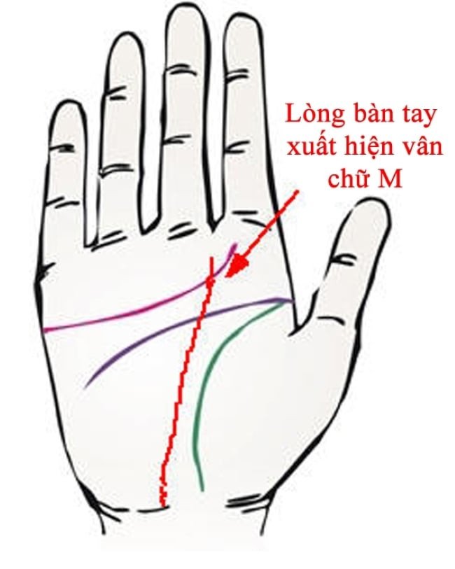 Đường chỉ tay vân chữ M