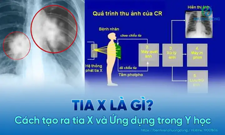 Khám Sức Khỏe Visa: Vai Trò X-quang và Quy Trình Chi Tiết Bạn Cần Biết Khám Sức Khỏe Visa: Vai Trò X-quang Và Quy Trình Chi Tiết Bạn Cần Biết
